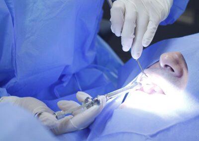 Intervención quirúrgica con el Doctor Iván Iso en Clínica dental Saura