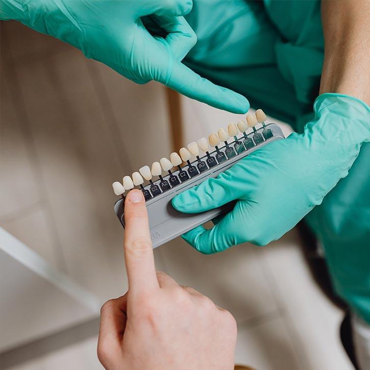 Carillas dentales clínica dental saura