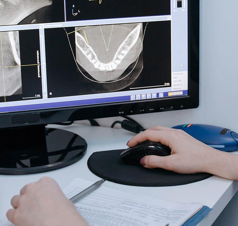 Escaner 3d intraoral clínica dental saura