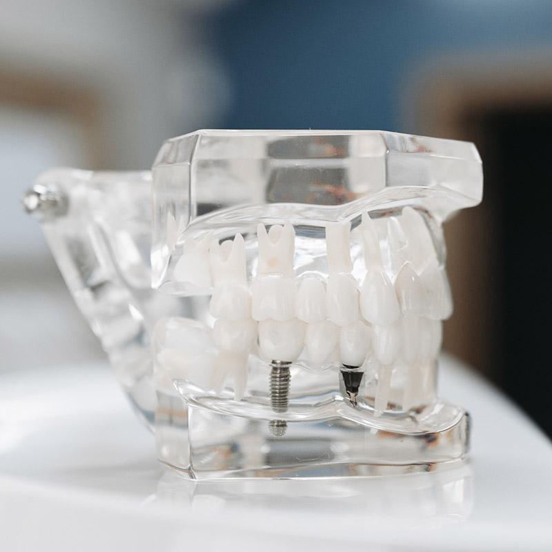 Implantologiía clínica dental saura