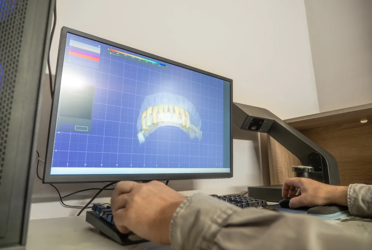 Diseño Digital de Sonrisa