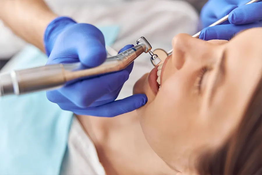 Limpieza dental profesional