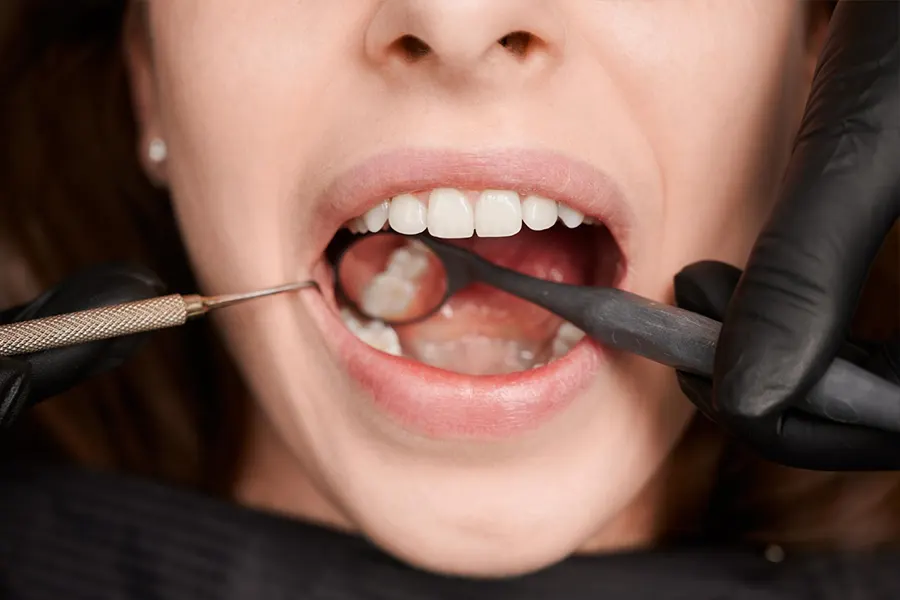 Tratamiento de periodontitis para una mujer en el dentista